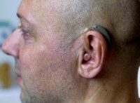 Слуховой аппарат: кому нужен, как выбрать и перестать стесняться